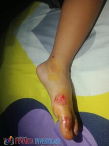 Gawat!! Percobaan Pembegalan Terjadi Lagi di Kelurahan Blambangan Umpu.