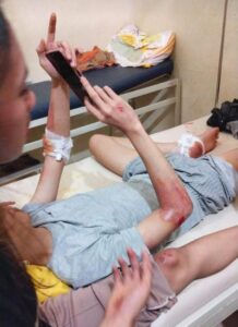 Masyarakat keluh kan Akses jalan Umpu Bhakti penghubung Umpu kencana dan jalan jalur perkantoran Pemda Waykanan Sering Memakan Korban disebab kan Jalan Rusak dan berlobang