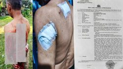 Penganiayaan Berat di Caringin Bogor: Wilson Lalengke Kecam Aksi Main Hakim Sendiri, Desak Polisi Usut Tuntas Terduga Pelaku ‘Imron’